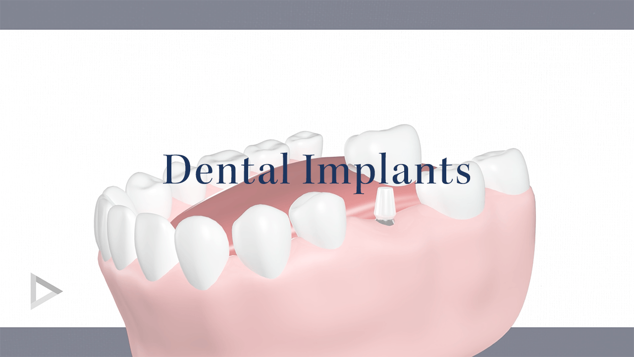 Invisalign, Drexel Hill, PA